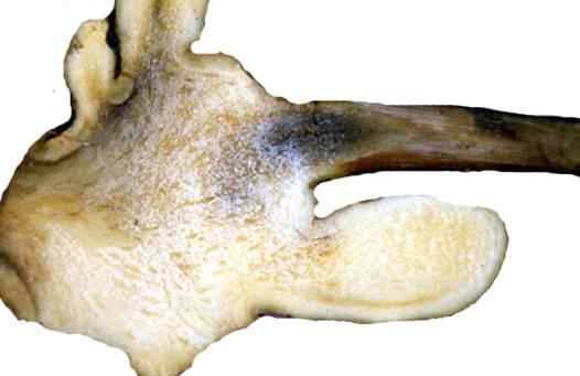 Ralstonia solanacearum